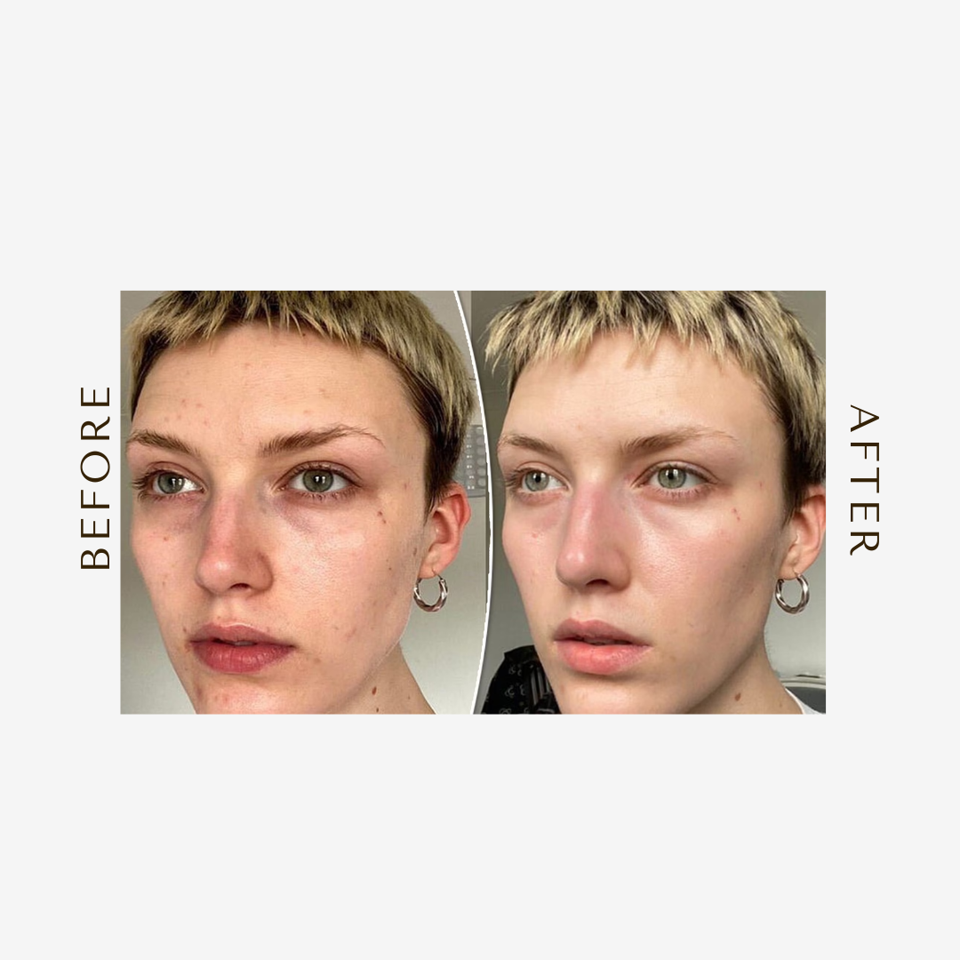 Moisturizing Eye Cream